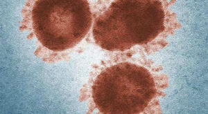 新冠病毒可能导致患者脑残