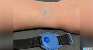 Omega x Swatct月球表被爆质感低廉还脱色